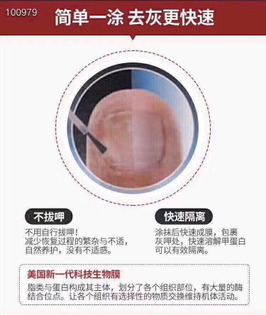 Fungi-Nail灰指甲药水 30ml液体的